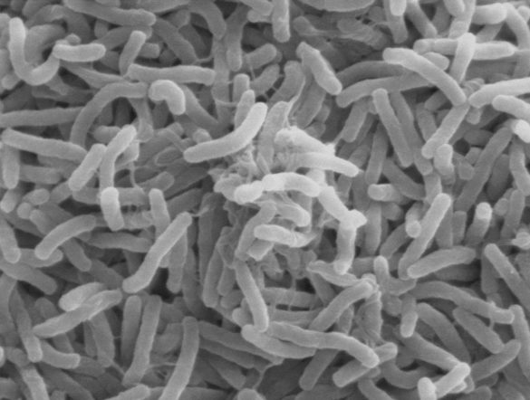 Cholera bacteria SEM
