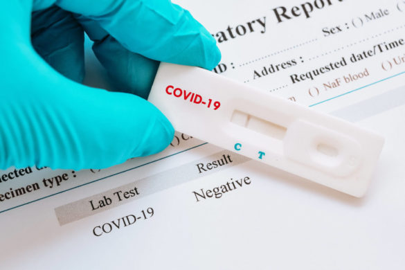 test antygenowy COVID 19
